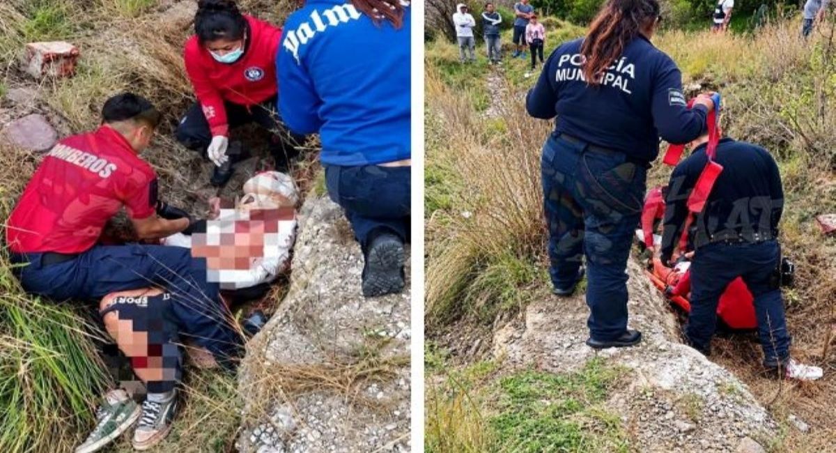 Muere hombre tras ataque de una jauría de perros pitbull en Acajete